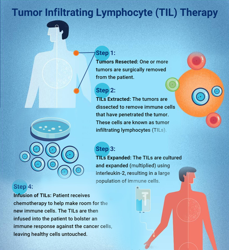 Diagram of bone structure, plasma cells, and multiple myeloma cells.