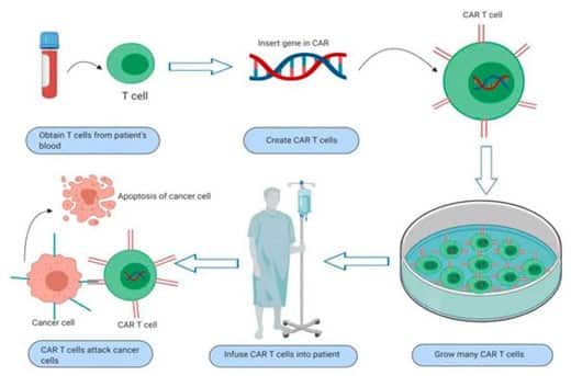 Brexucabtagene Autoleucel treatment process